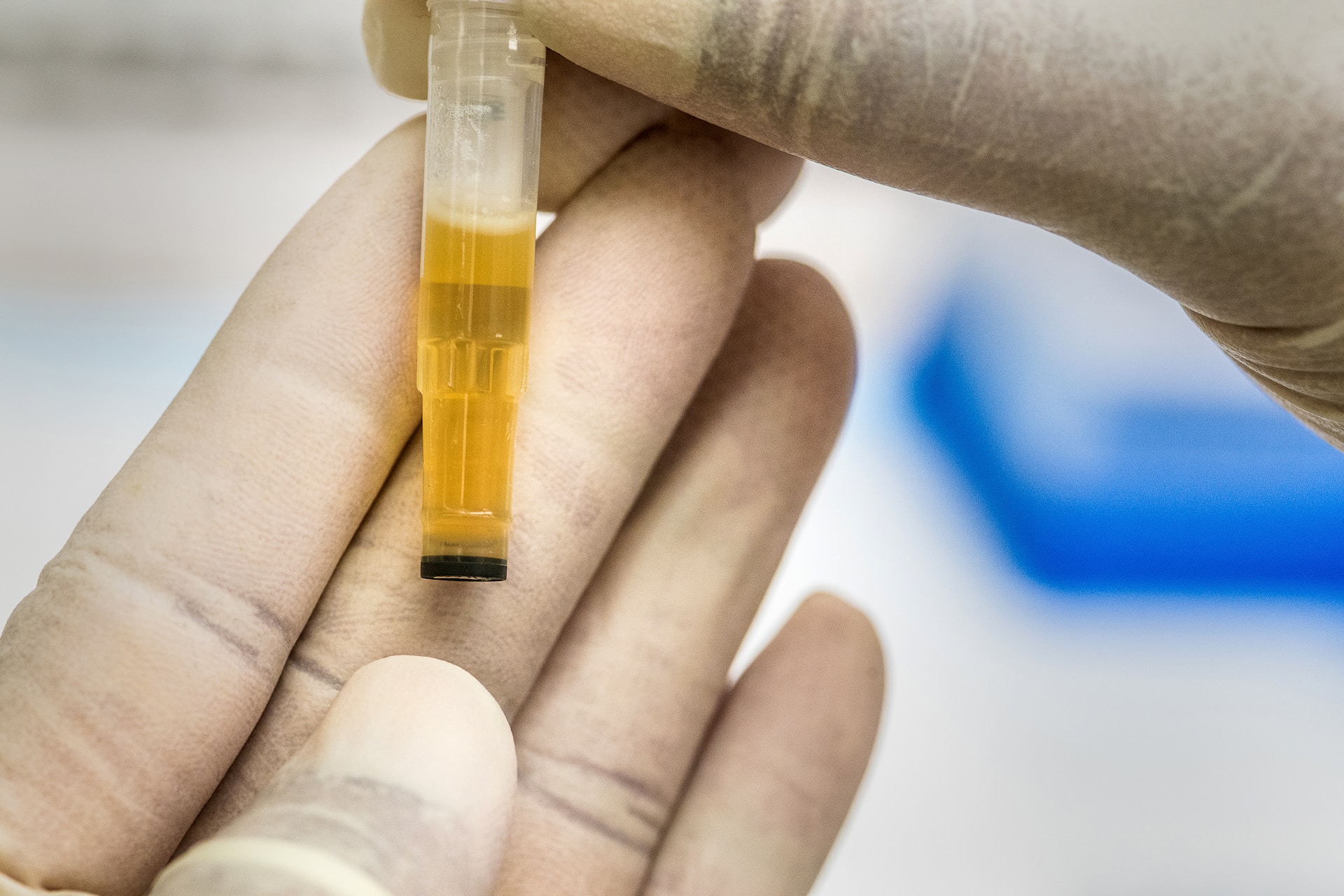 Classic Mistakes That You Need To Avoid With Workplace Drug Testing