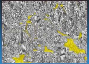 The Case for Combining Electron Microscopy and Microtomography