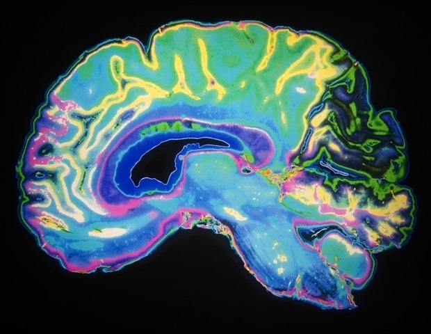 Uncovering origins of autism, depression, Parkinson’s in fetal brain