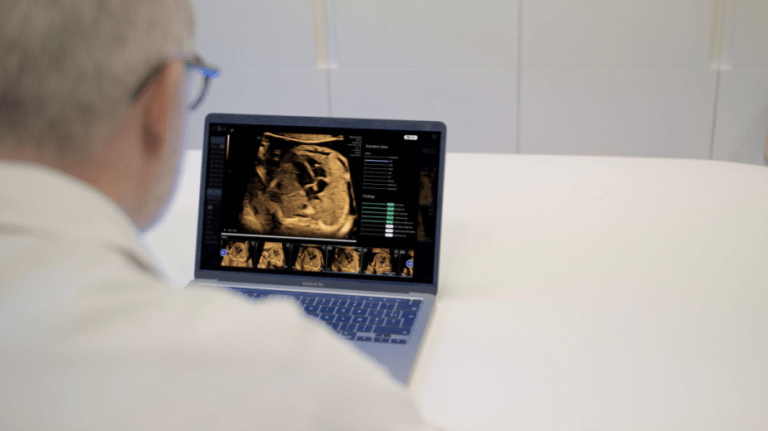 BrightHeart gains CE mark for prenatal ultrasound AI